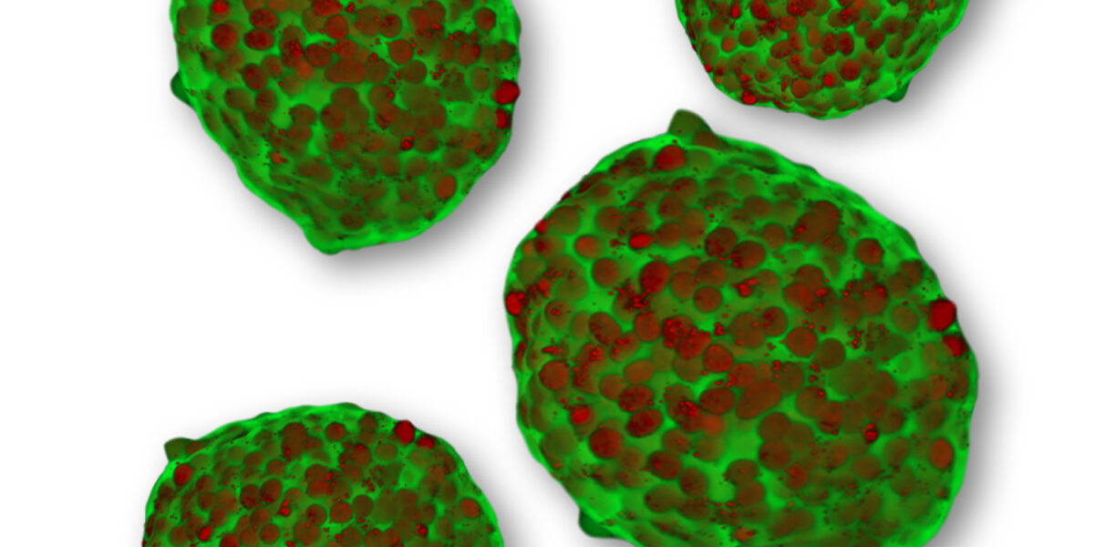 news-human-cell-design-new-endoc-bh5-human-beta-cells-standardized-3D-pseudo-islets